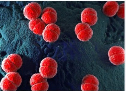 BỆNH VIÊM NÃO MÔ CẦU