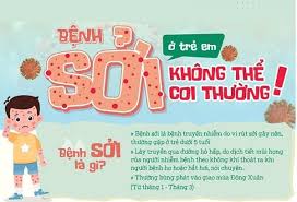 Bệnh sởi không thể coi thường