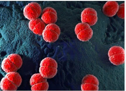 BỆNH VIÊM NÃO MÔ CẦU